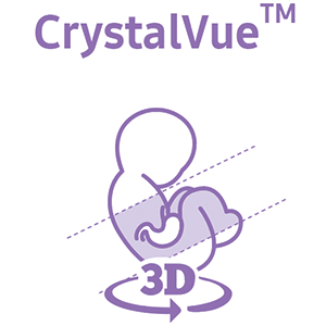 CrystalVue™